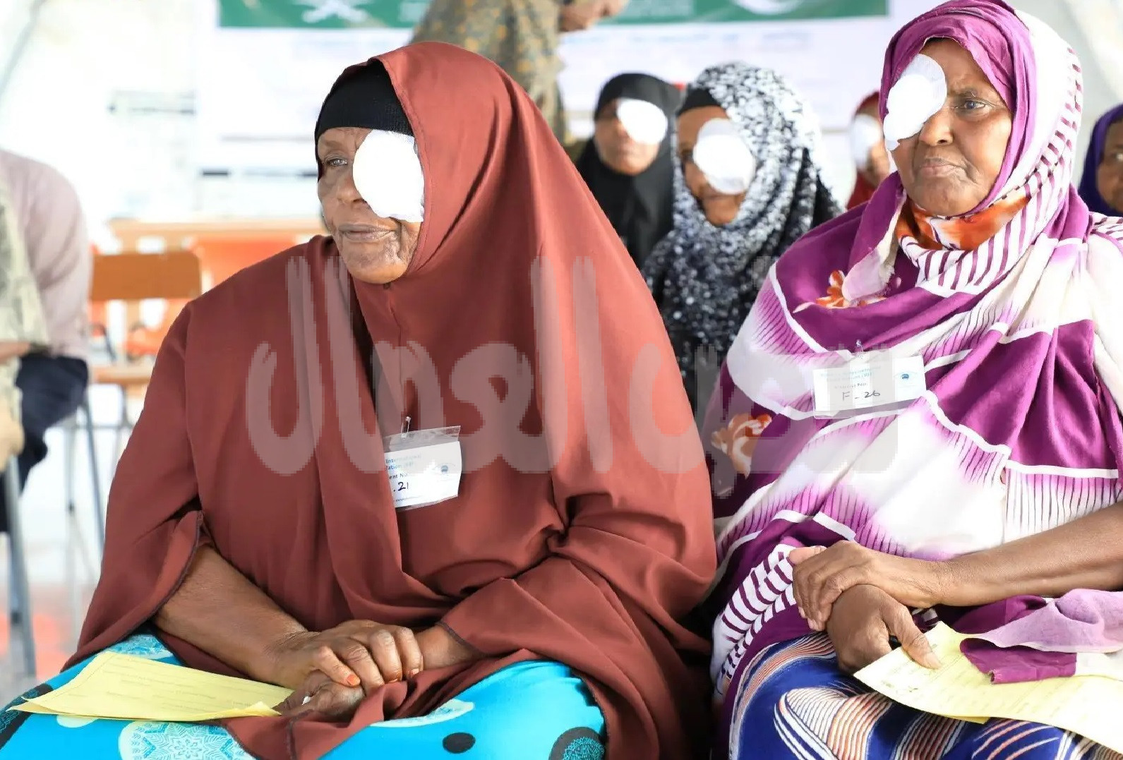 مركز الملك سلمان للإغاثة ينفذ برنامج نور السعودية لمكافحة العمى في مدن جروي بولاية بونتلاند في الصومال