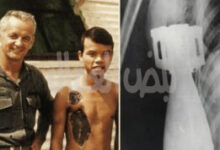 استقبل مستشفى بحري أمريكي قرب “دا نانغ” جندياً فيتنامياً شاباً يحمل داخل جسده قذيفة هاون عيار ٦٠ ملم لم تنفجر